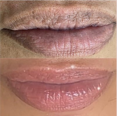 Lip Blush - Lip Blush brings back your youthful looking face with emphasizing your lip shape and lip color! Consultations can be available for any questions or concerns. Lip Blush can heal 40% lighter after 1st session. Which is why it is recommended to go bright and saturated on the 1st session. Touchup can add more color and perfect shape. Touchup is 6 weeks after. Lip Blush can last up to 3 years without touchups. Touchups after 1 year can be personal preference.