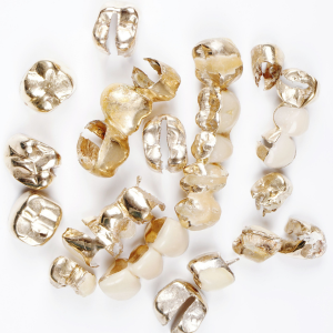 We Are Your Local Dental Scrap Gold Buyer - PGS Gold & Coin is the best place to go to get the most for dental scrap gold. As the premium gold buyer in Palatine, PGS Gold & Coin pays the most for your dental scrap. The process is easy to sell all types of gold at PGS so come in today! We Are Your Local Dental Scrap Gold Buyer - PGS Gold & Coin is the best place to go to get the most for dental scrap gold. As the premium gold buyer in Palatine, PGS Gold & Coin pays the most for your dental scrap. The process is easy to sell all types of gold at PGS so come in today!
