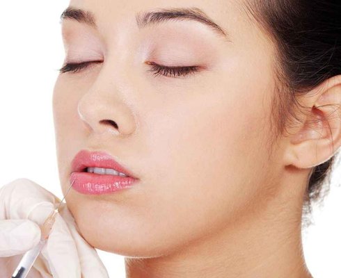 Cosmetic Enhancements (Non-Surgical) - Erasing signs of aging of the face can often be accomplished through the use of non-invasive treatments. Injectibles, such as Botox, can work both correctively and preventatively to quell the severity of muscle contractions responsible for frown lines, crows feet and lines on the forehead. Deeper lines around the mouth and nose (naso-labial folds), as well as thin, vertical lip lines, can benefit from fillers like Juvederm, Restylane or Radiesse. Expert skills and an artistic eye will achieve a natural look, giving the patient a more relaxed, subtly more youthful appearance. Injectibles are administered by our facial plastic surgeon, Howard Stupak, M.D. Cosmetic Enhancements (Non-Surgical) - Erasing signs of aging of the face can often be accomplished through the use of non-invasive treatments. Injectibles, such as Botox, can work both correctively and preventatively to quell the severity of muscle contractions responsible for frown lines, crows feet and lines on the forehead. Deeper lines around the mouth and nose (naso-labial folds), as well as thin, vertical lip lines, can benefit from fillers like Juvederm, Restylane or Radiesse. Expert skills and an artistic eye will achieve a natural look, giving the patient a more relaxed, subtly more youthful appearance. Injectibles are administered by our facial plastic surgeon, Howard Stupak, M.D.