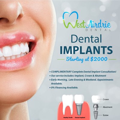 Implants - If you are looking for an effective and permanent solution for one or more missing teeth, dental implants might be right for you! Implants - If you are looking for an effective and permanent solution for one or more missing teeth, dental implants might be right for you!