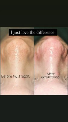 facials - all different types of facials facials - all different types of facials