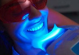 Teeth Whitening - Your teeth are full of tiny holes, so small that you can’t even see them. This means that, like sponges, your teeth will absorb the color of whatever you eat and drink. Over time, consuming wine, coffee, or dark berries can lead to tooth discoloration that might make you feel insecure about your smile. Here at Corte Madera Dentist – Julie Young, DDS, we’re proud to offer professional teeth whitening treatments that can help you get rid of stubborn tooth stains, fast! Plus, you can choose between in-office and take-home solutions, depending on your preferences. To learn more about your options for teeth whitening in Corte Madera, CA, contact us today! Teeth Whitening - Your teeth are full of tiny holes, so small that you can’t even see them. This means that, like sponges, your teeth will absorb the color of whatever you eat and drink. Over time, consuming wine, coffee, or dark berries can lead to tooth discoloration that might make you feel insecure about your smile. Here at Corte Madera Dentist – Julie Young, DDS, we’re proud to offer professional teeth whitening treatments that can help you get rid of stubborn tooth stains, fast! Plus, you can choose between in-office and take-home solutions, depending on your preferences. To learn more about your options for teeth whitening in Corte Madera, CA, contact us today!