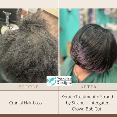 Hair Loss Solutions - Hair Loss Solutions at Posh Hair Designz has no Limits offering women who suffer from alopecia a wide variety of options and Illusions. Certified Hair Loss Specialist and Trichologist Practitioner Taneasha Hines is able to give you a short and Sassy cut, braided crochet, tension free extensions with Hair Care and hair loss Solutions.
