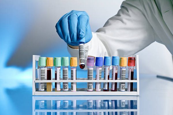 Lab Testing - Lab Testing
