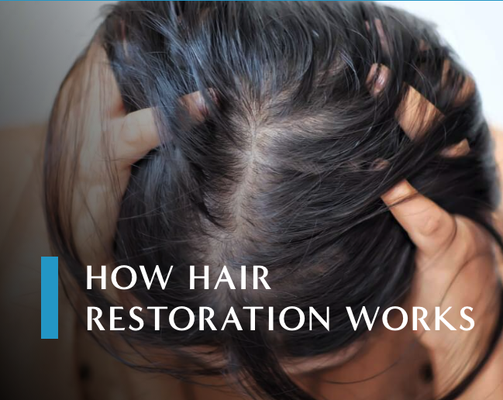 Hair Removal & Hair Restoration - e understand how both unwanted hair and hair thinning can impact your confidence. That’s why we offer proven, physician-supervised treatments—using today’s most advanced technology for reliable, natural results. Whether you’re seeking smooth, hair-free skin or improved hair growth, our expert team will customize your plan for your needs and goals.
Laser Hair Reduction
Experience freedom from shaving, waxing, and stubble with our state-of-the-art laser hair reduction. Using concentrated laser beams, this treatment targets the pigment in your hair follicles to inhibit and reduce future growth—providing a safe, long-lasting solution for both men and women across all skin types.
Ideal For: Removing unwanted hair on the face, underarms, arms, back, legs, bikini area, and more
Treatment Time: 20 minutes to 1 hour, based on area
Results: Smoother skin and dramatic reduction in hair growth after a series of sessions; future regrowth is finer and lighter
What to Expect: Minimal to no downtime; individualized laser settings and soothing techniques keep you comfortable from start to finish
Laser hair reduction offers a modern, permanent solution compared to regular shaving and waxing, so you can spend less time worrying about hair and more time enjoying your skin.
Hair Restoration with SYLFIRM X
Hair thinning and loss can happen to anyone—and we offer advanced, non-surgical options to help you restore your confidence. At Contour You, our leading-edge SYLFIRM X system uses radiofrequency (RF) microneedling technology to stimulate the scalp, revitalize dormant hair follicles, and promote stronger, healthier hair growth for men and women alike.
Ideal For: Thinning hair, early hair loss, bald patches, and those wanting to strengthen and thicken existing hair
How It Works: SYLFIRM X combines microneedling with RF energy, triggering natural healing in the scalp to awaken follicles and encourage new growth, while also improving scalp health overall
Benefits: Non-invasive, minimal discomfort, and little to no downtime; improvement in hair density, coverage, and hair quality after a series of sessions
What to Expect: Every plan is customized after a comprehensive scalp assessment. Results build gradually for a natural, fuller head of hair.
Throughout your hair restoration journey, the Contour You team provides education, honest expectations, and ongoing support to help you achieve—and maintain—real improvement.
Each protocol is customized, starting with an in-depth evaluation and scalp analysis. Dr. Siverhus reviews the latest research to ensure treatments are evidence-based and safe. Exosome therapy often delivers visible improvements in density, texture, and hair vitality after a series of sessions. For added benefit, we may pair exosomes with PRP or adjunctive therapies based on your unique needs.
Throughout your journey, we provide education, realistic expectations, and ongoing monitoring—helping you achieve a fuller, younger-looking head of hair with minimal downtime and maximum support. Hair Removal & Hair Restoration - e understand how both unwanted hair and hair thinning can impact your confidence. That’s why we offer proven, physician-supervised treatments—using today’s most advanced technology for reliable, natural results. Whether you’re seeking smooth, hair-free skin or improved hair growth, our expert team will customize your plan for your needs and goals.
Laser Hair Reduction
Experience freedom from shaving, waxing, and stubble with our state-of-the-art laser hair reduction. Using concentrated laser beams, this treatment targets the pigment in your hair follicles to inhibit and reduce future growth—providing a safe, long-lasting solution for both men and women across all skin types.
Ideal For: Removing unwanted hair on the face, underarms, arms, back, legs, bikini area, and more
Treatment Time: 20 minutes to 1 hour, based on area
Results: Smoother skin and dramatic reduction in hair growth after a series of sessions; future regrowth is finer and lighter
What to Expect: Minimal to no downtime; individualized laser settings and soothing techniques keep you comfortable from start to finish
Laser hair reduction offers a modern, permanent solution compared to regular shaving and waxing, so you can spend less time worrying about hair and more time enjoying your skin.
Hair Restoration with SYLFIRM X
Hair thinning and loss can happen to anyone—and we offer advanced, non-surgical options to help you restore your confidence. At Contour You, our leading-edge SYLFIRM X system uses radiofrequency (RF) microneedling technology to stimulate the scalp, revitalize dormant hair follicles, and promote stronger, healthier hair growth for men and women alike.
Ideal For: Thinning hair, early hair loss, bald patches, and those wanting to strengthen and thicken existing hair
How It Works: SYLFIRM X combines microneedling with RF energy, triggering natural healing in the scalp to awaken follicles and encourage new growth, while also improving scalp health overall
Benefits: Non-invasive, minimal discomfort, and little to no downtime; improvement in hair density, coverage, and hair quality after a series of sessions
What to Expect: Every plan is customized after a comprehensive scalp assessment. Results build gradually for a natural, fuller head of hair.
Throughout your hair restoration journey, the Contour You team provides education, honest expectations, and ongoing support to help you achieve—and maintain—real improvement.
Each protocol is customized, starting with an in-depth evaluation and scalp analysis. Dr. Siverhus reviews the latest research to ensure treatments are evidence-based and safe. Exosome therapy often delivers visible improvements in density, texture, and hair vitality after a series of sessions. For added benefit, we may pair exosomes with PRP or adjunctive therapies based on your unique needs.
Throughout your journey, we provide education, realistic expectations, and ongoing monitoring—helping you achieve a fuller, younger-looking head of hair with minimal downtime and maximum support.