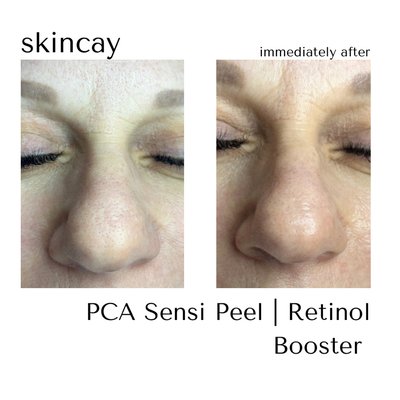 Services - Please visit skincay.glossgenius.com to see a full list of services.