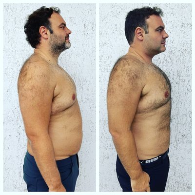 6 week transformation - New Evolve X treatments for 6 weeks 6 week transformation - New Evolve X treatments for 6 weeks