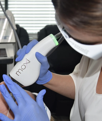 Sciton Moxi laser treatment - MOXI is a gentle, non-ablative laser treatment designed to refresh and brighten your skin with minimal downtime. It targets uneven tone, sun damage, and early signs of aging to reveal smoother, more radiant skin. Perfect for all skin types, MOXI delivers a youthful glow in a quick, comfortable session. Sciton Moxi laser treatment - MOXI is a gentle, non-ablative laser treatment designed to refresh and brighten your skin with minimal downtime. It targets uneven tone, sun damage, and early signs of aging to reveal smoother, more radiant skin. Perfect for all skin types, MOXI delivers a youthful glow in a quick, comfortable session.