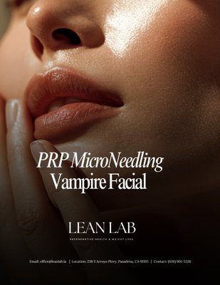 Vampire Facial - Looking for a Vampire Facial in Pasadena?
Lean Lab offers the famous Vampire Facial (PRP Microneedling) treatments designed to improve skin texture, tone, and collagen production.
This treatment combines microneedling with platelet-rich plasma to support natural skin rejuvenation and a refreshed appearance.
For enhanced results, the Vampire Facial can be paired with exosomes to support faster recovery and more advanced skin renewal.
Call us today! Vampire Facial - Looking for a Vampire Facial in Pasadena?
Lean Lab offers the famous Vampire Facial (PRP Microneedling) treatments designed to improve skin texture, tone, and collagen production.
This treatment combines microneedling with platelet-rich plasma to support natural skin rejuvenation and a refreshed appearance.
For enhanced results, the Vampire Facial can be paired with exosomes to support faster recovery and more advanced skin renewal.
Call us today!