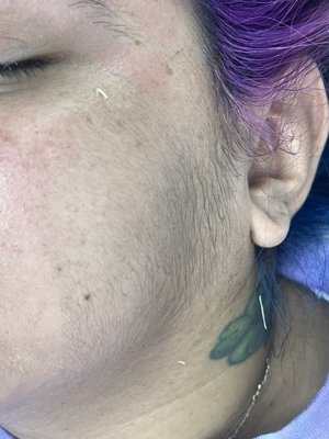 Full Face with Brows - My client came in today for a full face with brow wax. I waxed her forehead, brows, sides of face, cheeks, chin, lip and her neck.
The type of wax I used was an Italian soft wax made for sensitive skin.
Post wax: I applied hydrocortisone all over to relieve any redness and to keep her skin feeling hydrated. Full Face with Brows - My client came in today for a full face with brow wax. I waxed her forehead, brows, sides of face, cheeks, chin, lip and her neck.
The type of wax I used was an Italian soft wax made for sensitive skin.
Post wax: I applied hydrocortisone all over to relieve any redness and to keep her skin feeling hydrated.