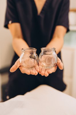 Cupping therapy at Lokahi - Cupping is an ancient Chinese therapy involving placing cups on the skin to create suction and promote healing. We use glass cups because we have more control over the suction strength, and the glass cups are far more easily sterilizable. It gained interest and popularity during the 2016 Olympics when swimmer Michael Phelps sported some round bruises on his back. 
Cupping can be used for a variety of conditions, such as:
low back pain
tight shoulders
arthritis
sports injury
asthma
headaches, including migraines
non-specific aches and pains

If You want to learn more about cupping or any of our other services, please don't hesitate to contact us today.