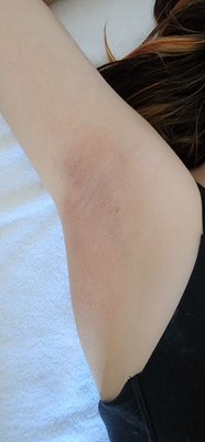 Sugar Hair Removal - Tailored for the tender. Our sugaring method loves your skin as much as you do.
No long waits between services
With just 1/8th of an inch of hair needed, readiness is never an issue.
Gentle on Your Skin, Tough on Hair: Experience less irritation compared to waxing – say goodbye to redness and hello to radiance!
🐰 Kindness in Every Touch: Our 100% Cruelty-Free promise ensures beauty without compromise.
Significantly reduces ingrown hairs!
Less heat is needed for the formula, which can make it more comfortable than waxing. Sugar Hair Removal - Tailored for the tender. Our sugaring method loves your skin as much as you do.
No long waits between services
With just 1/8th of an inch of hair needed, readiness is never an issue.
Gentle on Your Skin, Tough on Hair: Experience less irritation compared to waxing – say goodbye to redness and hello to radiance!
🐰 Kindness in Every Touch: Our 100% Cruelty-Free promise ensures beauty without compromise.
Significantly reduces ingrown hairs!
Less heat is needed for the formula, which can make it more comfortable than waxing.