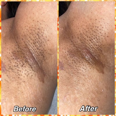 See the AMAZING results! - The proof is the results! Here are some of my clients before and afters of their waxing services. See the AMAZING results! - The proof is the results! Here are some of my clients before and afters of their waxing services.