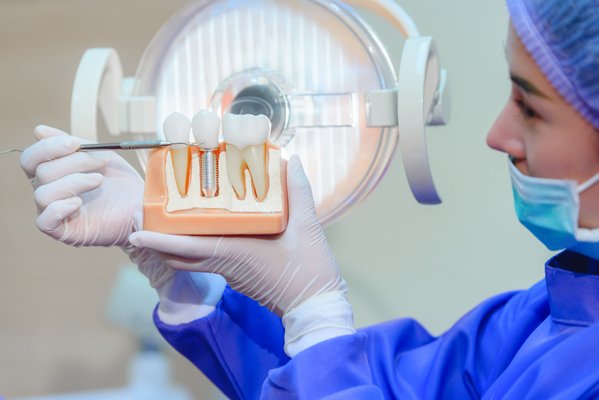 Dental Implants - Multiple visits are required for the entire implantation process, starting with x-rays and scans to assess how to proceed. An oral surgeon or periodontist can place the implant. When the area is numb, the artificial roots of the implant are fitted in the jawbone. The area heals around the implant in a process called osseointegration, making the implant an integral part of the jaw structure. The reconstruction, or addition of the outer tooth, is added after the jaw has healed completely. Dental Implants - Multiple visits are required for the entire implantation process, starting with x-rays and scans to assess how to proceed. An oral surgeon or periodontist can place the implant. When the area is numb, the artificial roots of the implant are fitted in the jawbone. The area heals around the implant in a process called osseointegration, making the implant an integral part of the jaw structure. The reconstruction, or addition of the outer tooth, is added after the jaw has healed completely.
