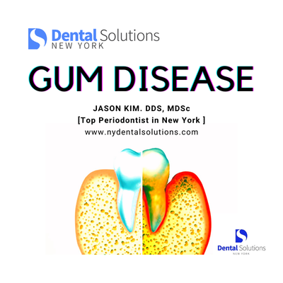 Gum Disease Laser Treatment - Laser Dentistry typically uses lasers to remove or shape tissue or for targeted therapies, such as Laser Periodontal Therapy, where lasers can target the bacteria associated with periodontitis, also known as gum disease. For the hard tissue of teeth, the lasers used are those whose wavelengths target the combination of water and the mineral specific to the tooth structure. For the soft tissue of the gums, the lasers used are ones whose wavelengths target the water and hemoglobin found in the gums. Gum Disease Laser Treatment - Laser Dentistry typically uses lasers to remove or shape tissue or for targeted therapies, such as Laser Periodontal Therapy, where lasers can target the bacteria associated with periodontitis, also known as gum disease. For the hard tissue of teeth, the lasers used are those whose wavelengths target the combination of water and the mineral specific to the tooth structure. For the soft tissue of the gums, the lasers used are ones whose wavelengths target the water and hemoglobin found in the gums.