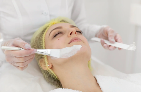 Chemical Peels - Call for more info 5162233117 Chemical Peels - Call for more info 5162233117