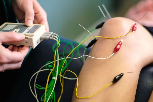 Need Immediate Pain Relief? - Types of Pain Addressed:
Chronic Pain: Conditions like lower back pain, osteoarthritis, fibromyalgia, and migraine.
Musculoskeletal Pain: Joint pain, neck pain, and muscle soreness.
Neuropathic Pain: Nerve-related pain, such as neuropathy or sciatica.
Postoperative Pain: Pain after surgical procedures.
Menstrual Pain: Dysmenorrhea (painful periods) and other menstrual-related discomfort.
Acupuncture for Pain Management?
In simple terms, the secret is that pain stems from blood not flowing freely through that area of the body, or through that Meridian. Like when there is a strain, sprain or swelling in an area. Both Energy and Blood flow slows through that area causing pain. Often you notice this in any of the areas prone to blood stasis or stagnation or tissue constriction after long standing or sitting. Acupuncture stimulates free flow of both Energy and Blood, Relieving your pain.
From a Biomedical perspective, acupuncture is proven to influence nerve signaling, release endorphins (natural pain-relieving chemicals), and modulate neurotransmitters/pain signals. AT The NAET Clinic TCM Pain Management Physicians use Acupuncture to improve blood circulation and reduce inflammation, relieving your pain.
Schedule your Pain relief session
Insurance Accepted Need Immediate Pain Relief? - Types of Pain Addressed:
Chronic Pain: Conditions like lower back pain, osteoarthritis, fibromyalgia, and migraine.
Musculoskeletal Pain: Joint pain, neck pain, and muscle soreness.
Neuropathic Pain: Nerve-related pain, such as neuropathy or sciatica.
Postoperative Pain: Pain after surgical procedures.
Menstrual Pain: Dysmenorrhea (painful periods) and other menstrual-related discomfort.
Acupuncture for Pain Management?
In simple terms, the secret is that pain stems from blood not flowing freely through that area of the body, or through that Meridian. Like when there is a strain, sprain or swelling in an area. Both Energy and Blood flow slows through that area causing pain. Often you notice this in any of the areas prone to blood stasis or stagnation or tissue constriction after long standing or sitting. Acupuncture stimulates free flow of both Energy and Blood, Relieving your pain.
From a Biomedical perspective, acupuncture is proven to influence nerve signaling, release endorphins (natural pain-relieving chemicals), and modulate neurotransmitters/pain signals. AT The NAET Clinic TCM Pain Management Physicians use Acupuncture to improve blood circulation and reduce inflammation, relieving your pain.
Schedule your Pain relief session
Insurance Accepted