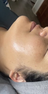 Dermaplaning - Experience the ultimate in smooth, radiant skin with our dermaplaning service. Say goodbye to peach fuzz and dead skin cells, revealing a flawless complexion. Unveil your natural beauty – book your dermaplaning session today! Dermaplaning - Experience the ultimate in smooth, radiant skin with our dermaplaning service. Say goodbye to peach fuzz and dead skin cells, revealing a flawless complexion. Unveil your natural beauty – book your dermaplaning session today!