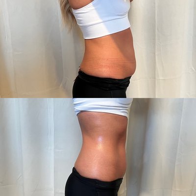 Client Before & After Photos - Client Before and after Photos