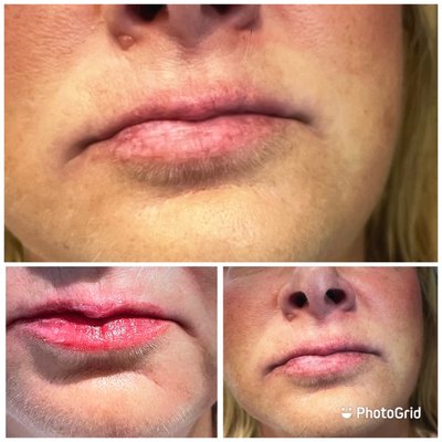 Lip blushing - Before and after for Lip Blushing Lip blushing - Before and after for Lip Blushing