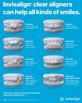 Invisalign - please connect with us at (760) 744 4444 to schedule a free consultation for Invisalign treatment by an experienced board-certified orthodontist. Invisalign - please connect with us at (760) 744 4444 to schedule a free consultation for Invisalign treatment by an experienced board-certified orthodontist.