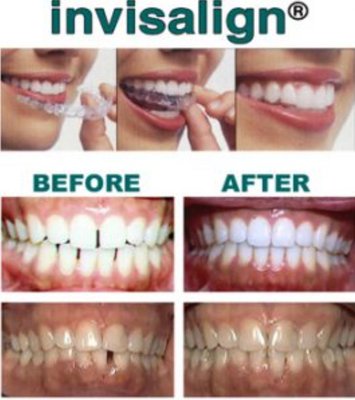 Cosmetic Dental Work - Boulder Hill Dental does all types of Dentistry from general to cosmetic. Cosmetic Dental Work - Boulder Hill Dental does all types of Dentistry from general to cosmetic.