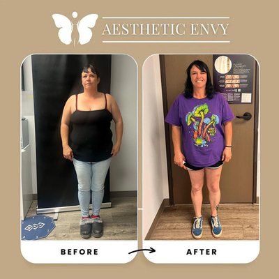 Weight Loss Treatment - ✨ You've tried it all — diets, workouts, even skipping dessert 🍰... but the scale won’t budge?
💡 It’s not your fault — your body just needs the right help.

🔥 At Aesthetic Envy, we make body transformations possible — not painful.
💆‍♀️ Custom treatments. Real results. Confidence redefined.

Ready for your before & after moment? 👇