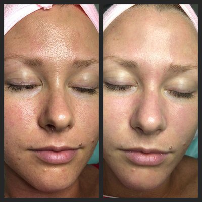 Glowy and Helathy Skin Look! - Let your skin Breathe - Enhance it today!
Skincare treatments, Face Lifting Massages, Deep Cleansing Facials, Acne therapy,
Peels and many more. We love to make our clients happy and even more beautiful! Glowy and Helathy Skin Look! - Let your skin Breathe - Enhance it today!
Skincare treatments, Face Lifting Massages, Deep Cleansing Facials, Acne therapy,
Peels and many more. We love to make our clients happy and even more beautiful!