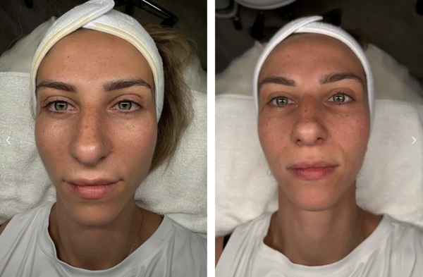 Skincare & Facials - Skincare & Facials Skincare & Facials - Skincare & Facials