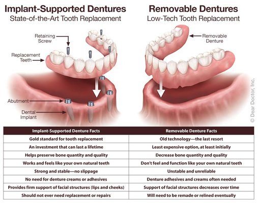 Dentures - provides a wide range of denture solutions at affordable prices, Gen Z Dentistry is the place to turn. Our experienced dentists will help you find the best type of dentures for your lifestyle and budget. Call now and book your appointment!