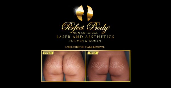 Perfect Body Laser Amp Aesthetics 36 Photos 200 Reviews Laser Hair Removal 1150 Sunrise Hwy Bay Shore Ny Phone Number Services Yelp