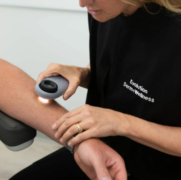 Dermatology - The skin is the body’s largest organ and protects us from the outside world. The high-altitude environment and outdoor active lifestyles that we enjoy in Colorado puts your skin at increased risk for skin cancer.
A full-skin exam with our skilled and experienced providers can help detect spots of concern and provides education about best practices to reduce risks of skin cancer and sun damage.
We offer comprehensive care for the health of your skin. The skin is the body’s largest organ and protects us from the outside world. Which makes it so important for you to be aware and take care of your skin! Dermatology - The skin is the body’s largest organ and protects us from the outside world. The high-altitude environment and outdoor active lifestyles that we enjoy in Colorado puts your skin at increased risk for skin cancer.
A full-skin exam with our skilled and experienced providers can help detect spots of concern and provides education about best practices to reduce risks of skin cancer and sun damage.
We offer comprehensive care for the health of your skin. The skin is the body’s largest organ and protects us from the outside world. Which makes it so important for you to be aware and take care of your skin!