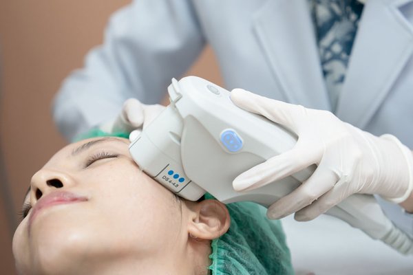 ultherapy non-surgical face and neck lift - non-surgical face lift with ultherapy. the natural looking results