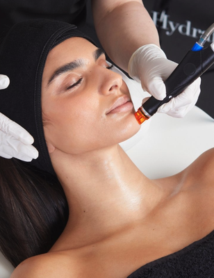 Hydrafacial - Our non-invasive treatment improves skin health, addresses individual concerns, and creates a glow like no other. Unlike traditional facials, it’s performed via device rather than by hand, for deeper penetration and longer lasting results. 

 The magic is in the wand, which works like a vacuum to open pores for a deep cleanse and easy extraction of impurities and dead skin cells. It also allows the active ingredients in our boosters to penetrate deeper, for the most effective treatment possible.