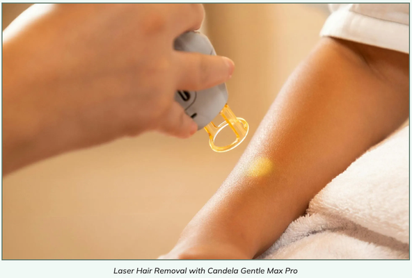 Laser Hair Removal - Laser Hair Removal is a safe and effective way to treat unwanted facial and body hair. Laser Hair Removal works by targeting the pigmentation in the hair follicle and destroys the hair at the root. As we age our hair loses pigmentation and laser hair removal will no longer be effective (Laser does not treat red, white, blonde, or grey hairs) so it's best to treat the hairs before they start changing color.
Laser Hair Removal helps with ingrown hairs, Keratosis Pilaris, and even acne related to hair growth.
At Expert Skin Solutions we have mastered the technique to safely and effectively reduce unwanted hair - our proprietary technique comprehensively treats the skin and allows for more energy to be delivered without compromising your skin health. Laser Hair Removal - Laser Hair Removal is a safe and effective way to treat unwanted facial and body hair. Laser Hair Removal works by targeting the pigmentation in the hair follicle and destroys the hair at the root. As we age our hair loses pigmentation and laser hair removal will no longer be effective (Laser does not treat red, white, blonde, or grey hairs) so it's best to treat the hairs before they start changing color.
Laser Hair Removal helps with ingrown hairs, Keratosis Pilaris, and even acne related to hair growth.
At Expert Skin Solutions we have mastered the technique to safely and effectively reduce unwanted hair - our proprietary technique comprehensively treats the skin and allows for more energy to be delivered without compromising your skin health.