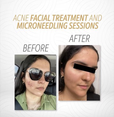 Hello Youth, Glow, Healthy Skin. - Never is too late to take care of your skin. Hello Youth, Glow, Healthy Skin. - Never is too late to take care of your skin.