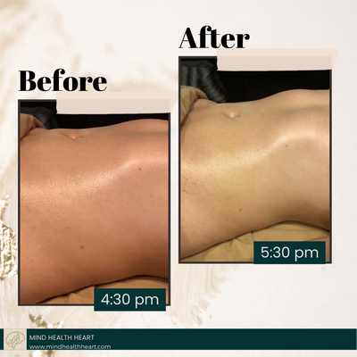 Lymphatic Drainage - Lymphatic Drainage is a great way to reduce bloating, remove toxins and improves the overall immune system. 
These sessions can be done as often as once a week. These before and after pictures portray the amazing results from lymphatic drainage.