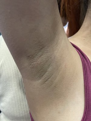 Body wax - We have body wax available! Under arms, Brazilian, bikini, legs, arms, facial … visit our website Body wax - We have body wax available! Under arms, Brazilian, bikini, legs, arms, facial … visit our website