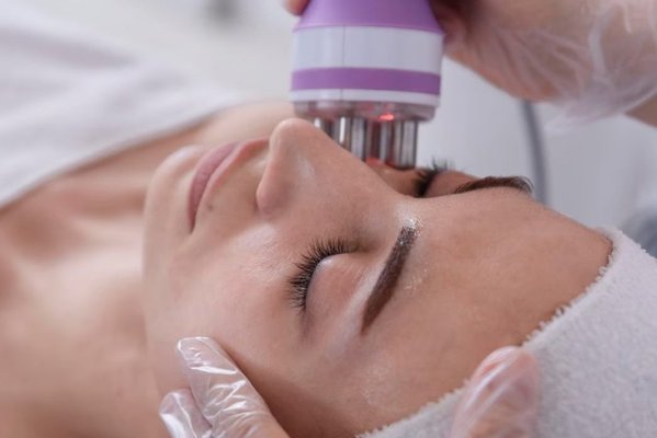 RF Lifting - Our RF Lifting Treatment is a revolutionary service that is designed to help you achieve a more youthful and rejuvenated appearance. This treatment targets the fat layer under your skin, which can cause wrinkles and fine lines to form.
We use a specialized machine that emits infrared light to heat the fat layer under your skin during the treatment. This heat helps to dissolve and break down the fat, which smooths out wrinkles and fine lines. The infrared light also promotes collagen production and the growth of new skin cells, which helps improve your skin's overall structure and condition.
One of the key benefits of our RF Lifting Treatment is that it is highly effective at diminishing fine lines and wrinkles, leaving your skin looking smoother and more youthful. The treatment also helps to correct the structure of your face, which can improve your overall appearance and give you a more youthful and rejuvenated look.
At the end of your RF Lifting Treatment, you will notice an immediate improvement in the appearance of your skin. Your skin will be smoother, firmer, and more radiant, with a youthful glow that lasts for weeks. RF Lifting - Our RF Lifting Treatment is a revolutionary service that is designed to help you achieve a more youthful and rejuvenated appearance. This treatment targets the fat layer under your skin, which can cause wrinkles and fine lines to form.
We use a specialized machine that emits infrared light to heat the fat layer under your skin during the treatment. This heat helps to dissolve and break down the fat, which smooths out wrinkles and fine lines. The infrared light also promotes collagen production and the growth of new skin cells, which helps improve your skin's overall structure and condition.
One of the key benefits of our RF Lifting Treatment is that it is highly effective at diminishing fine lines and wrinkles, leaving your skin looking smoother and more youthful. The treatment also helps to correct the structure of your face, which can improve your overall appearance and give you a more youthful and rejuvenated look.
At the end of your RF Lifting Treatment, you will notice an immediate improvement in the appearance of your skin. Your skin will be smoother, firmer, and more radiant, with a youthful glow that lasts for weeks.