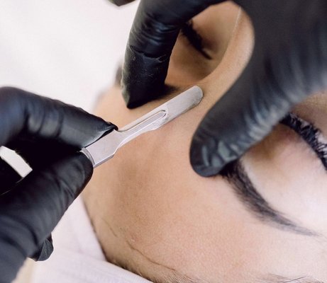 Dermaplane - Dermaplane removes dead skin and Vellus hair (peach fuzz) for a smoother surface, helps for quicker product penetration, diminish the appearance of fine lines and wrinkles, improves skin brightness and helps to reduce acne scars. Dermaplane - Dermaplane removes dead skin and Vellus hair (peach fuzz) for a smoother surface, helps for quicker product penetration, diminish the appearance of fine lines and wrinkles, improves skin brightness and helps to reduce acne scars.