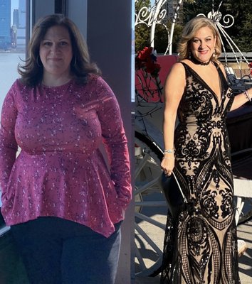 Before and After - Holistic healing from within. Check out this before and after. Before and After - Holistic healing from within. Check out this before and after.
