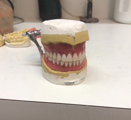 Same Day Denture Repair - We offer same day emergency denture repair since our lab is in-office. Call today and let us help! Same Day Denture Repair - We offer same day emergency denture repair since our lab is in-office. Call today and let us help!