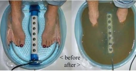Ionic Detox Foot Bath - The Ionic Detox Foot Bath is one of fastest ways to assist the body in the detoxification process . Our system has been scientifically proven to help the body release back toxins.