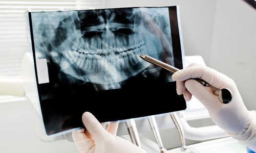 ANISHA NGUYEN, DDS - MILE SQUARE PARK FAMILY DENTAL GROUP - Updated May ...