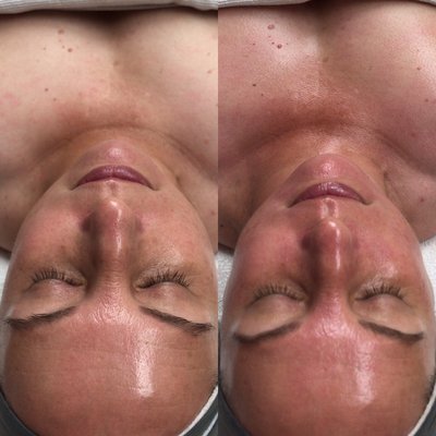 Facials - Skin Spa offers a variety of different facials, peels, treatments, and enhancements.
To Schedule an Appointment please visit our website at https://www.skinspariverside.com/face/ ! Facials - Skin Spa offers a variety of different facials, peels, treatments, and enhancements.
To Schedule an Appointment please visit our website at https://www.skinspariverside.com/face/ !