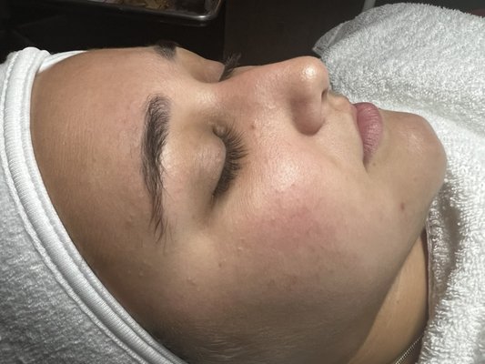 Seasonal Pore-Fecting Pumpkin Facial - This beauty had some dry and depleted skin, with some congestion. We cleared that up during her facial and finished with extractions. Talk about glow afterwards, it is exactly what my client needed.