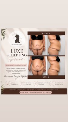Luxe Sculpting Session Results - Luxe Sculpting Session ✨
Our signature Luxe Sculpting Session combines ultrasonic cavitation, radio frequency skin tightening, EMS, and manual lymphatic drainage to help contour stubborn areas, improve skin firmness, and support your body’s natural detox process. This non-invasive treatment is customized to your goals with no downtime. Luxe Sculpting Session Results - Luxe Sculpting Session ✨
Our signature Luxe Sculpting Session combines ultrasonic cavitation, radio frequency skin tightening, EMS, and manual lymphatic drainage to help contour stubborn areas, improve skin firmness, and support your body’s natural detox process. This non-invasive treatment is customized to your goals with no downtime.