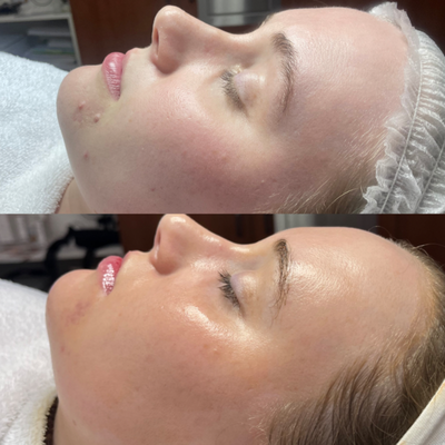 Facials - Each facial is customized to the skin's needs at every single appointment. Facials - Each facial is customized to the skin's needs at every single appointment.