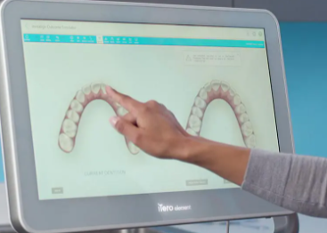 Invisalign - Are you ready to love your smile? Monaca Dentistry is your top choice for discreet, comfortable Invisalign treatment! Do you dream of a straighter, healthier smile? Invisalign is the global leader in modern orthodontics! Our experienced dentists at Monaco Dentistry are proud to transform smiles in our community with Invisalign clear aligners. Schedule a consultation today to learn more about the life-changing benefits of Invisalign treatment.
