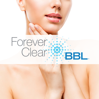BBL IPL (Intense Pulse Light) - At Sculpt MD, we use a more robust and effective IPL photofacial than is found in most clinics. The BroadBand Light therapy IPL treatment can honestly be called “age-reversing.” This next-generation IPL system produces a remarkable improvement in skin quality. When you undergo an IPL photofacial at Sculpt MD, you will be treated with a state-of-the-art system that achieves superior results and true skin rejuvenation. BBL IPL (Intense Pulse Light) - At Sculpt MD, we use a more robust and effective IPL photofacial than is found in most clinics. The BroadBand Light therapy IPL treatment can honestly be called “age-reversing.” This next-generation IPL system produces a remarkable improvement in skin quality. When you undergo an IPL photofacial at Sculpt MD, you will be treated with a state-of-the-art system that achieves superior results and true skin rejuvenation.